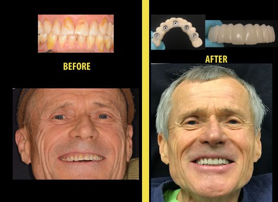 Before and after dental work