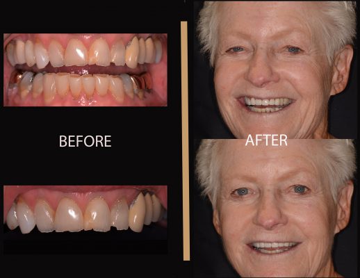 Before and after dental work